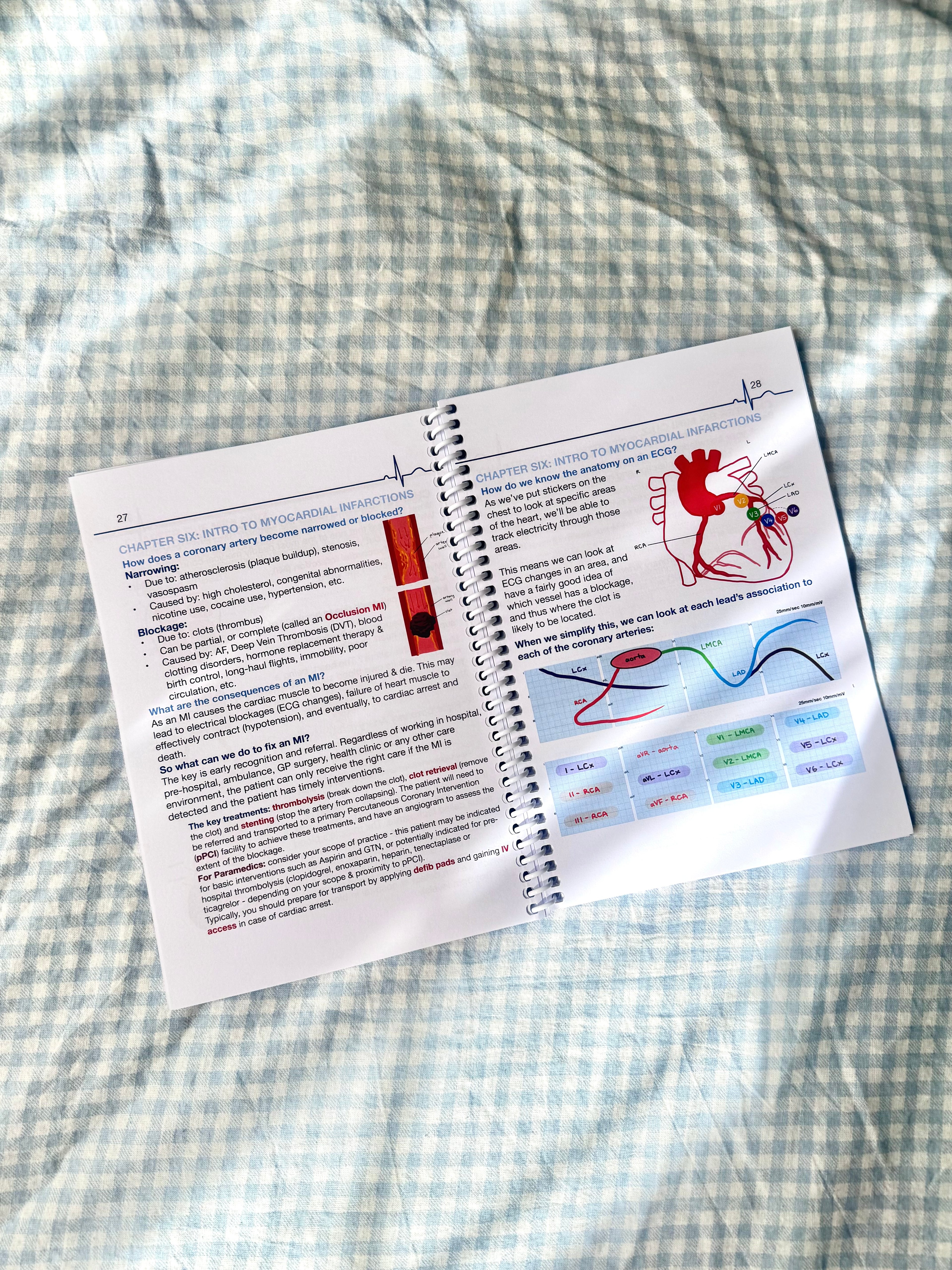 (Hard Copy) COMPLETE ECG SERIES: Book One & Book Two