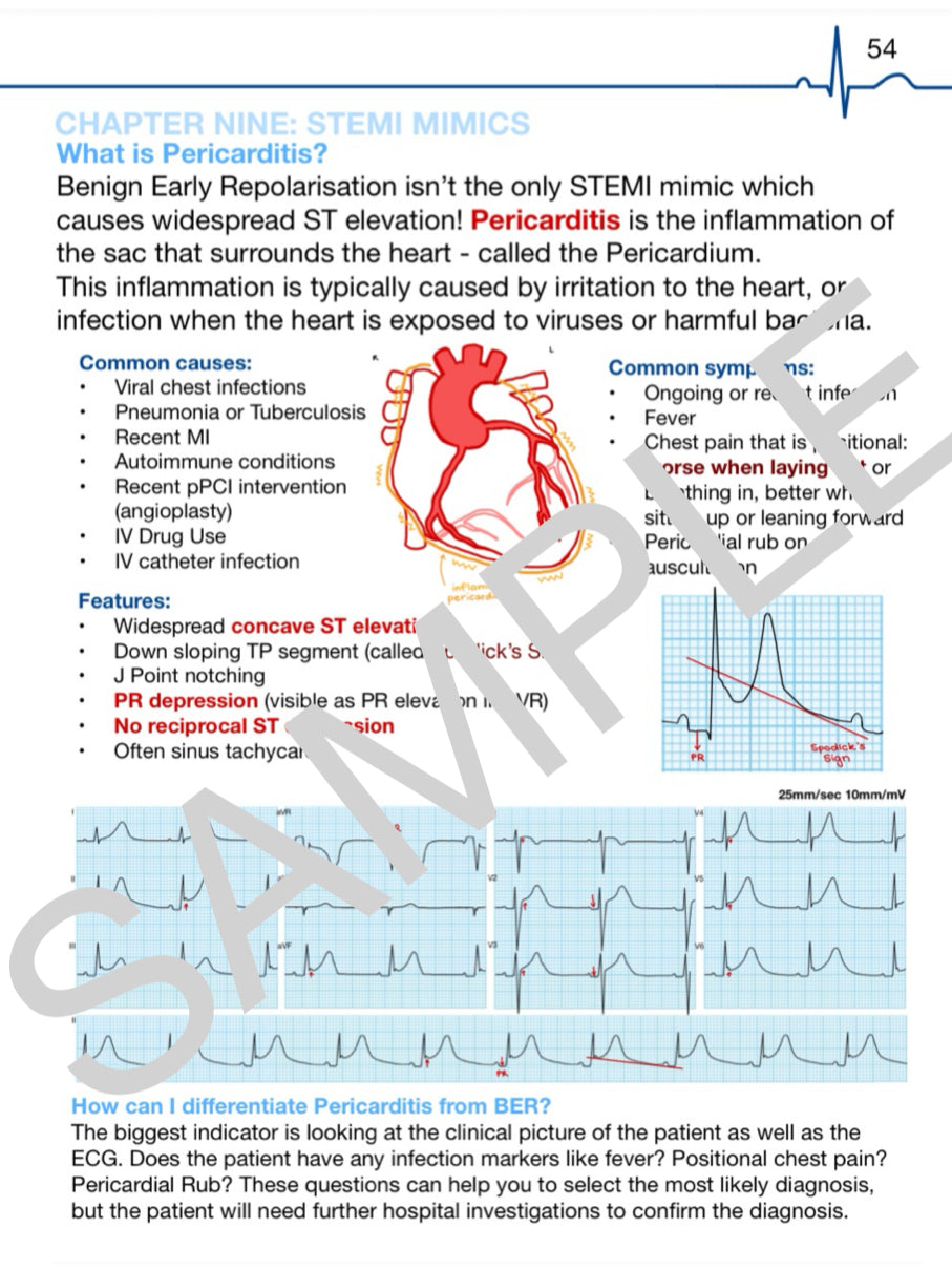 (eBooks) The Complete ECG SERIES: Book One & Two
