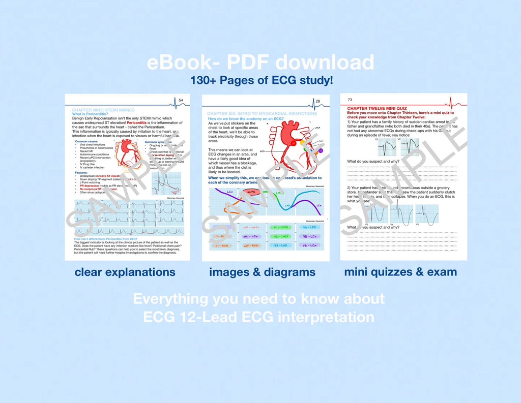 (eBooks) The Complete ECG SERIES: Book One & Two