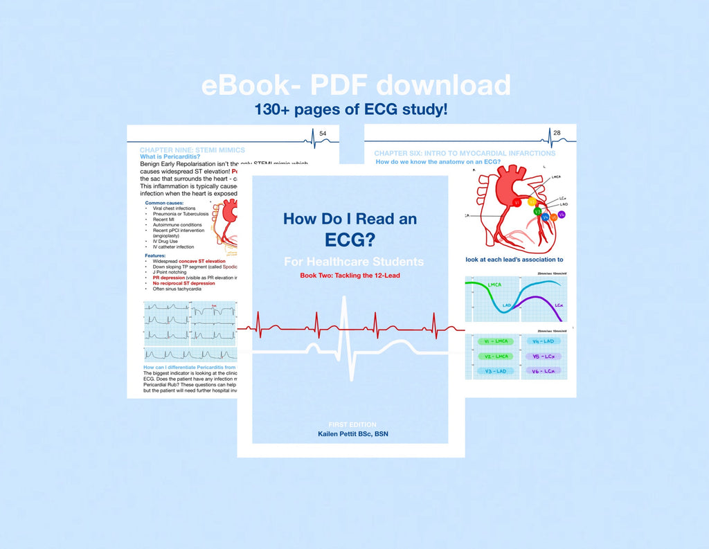 (eBooks) The Complete ECG SERIES: Book One & Two