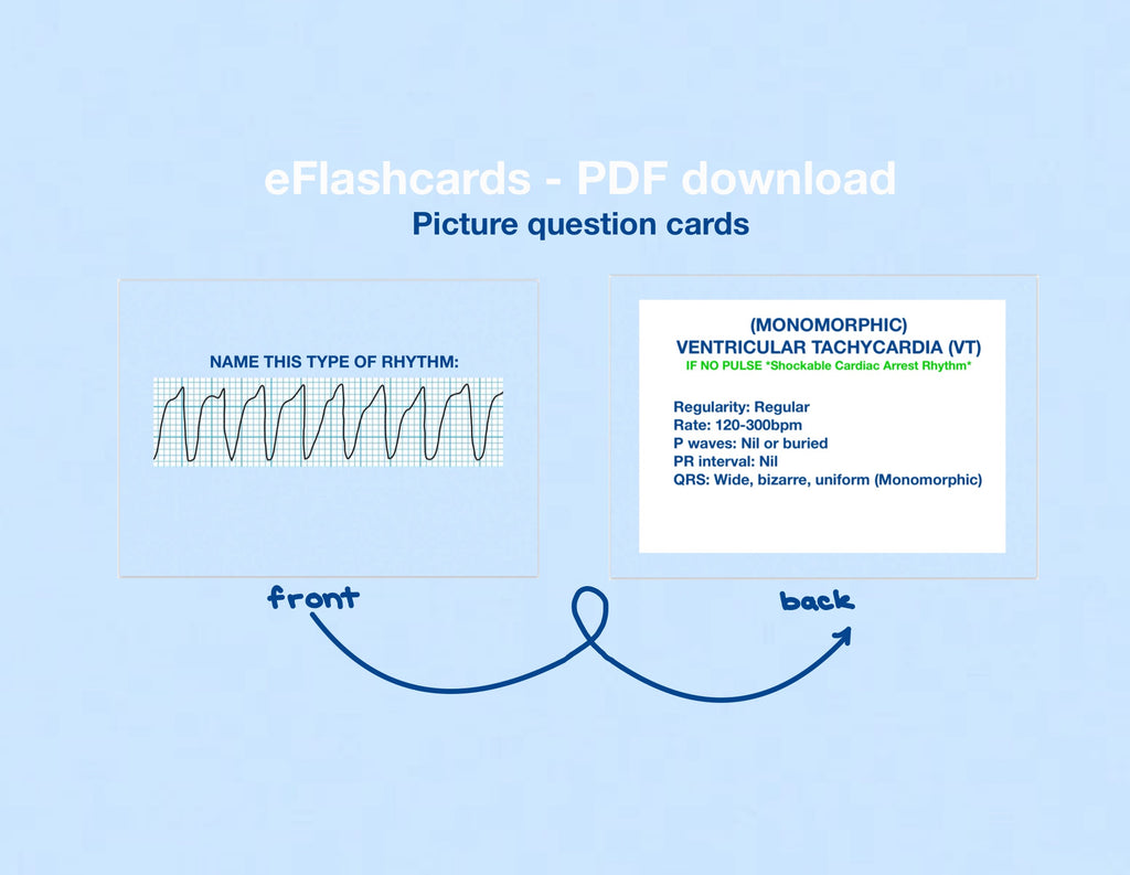 ⭐️NEW! (PDF) ECG Rhythms Flashcards