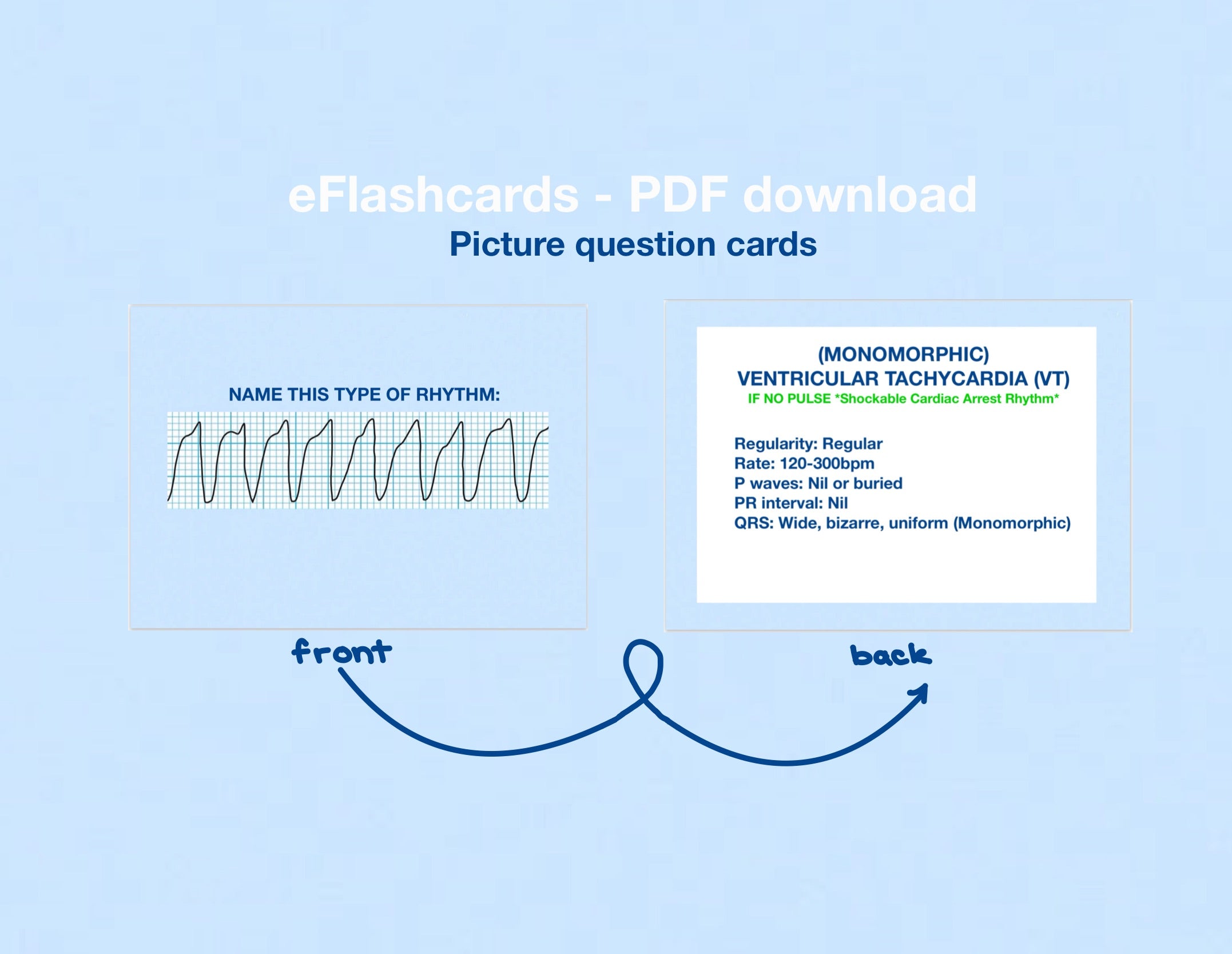 ⭐️NEW! (PDF) ECG Rhythms Flashcards
