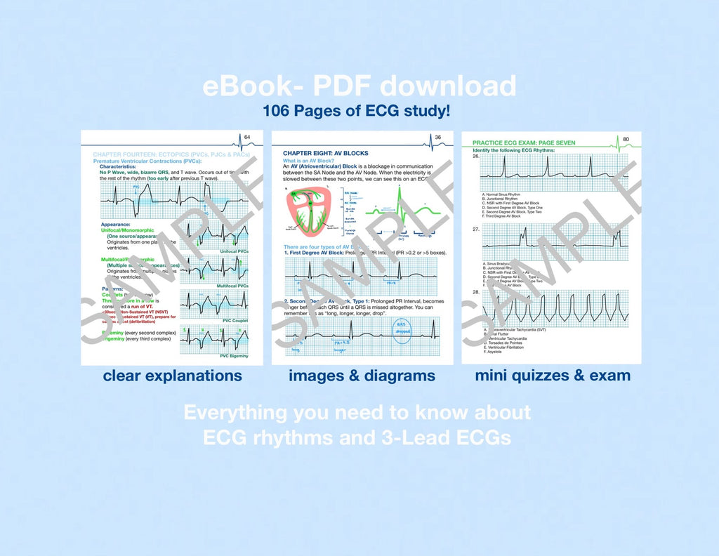 🌟(eBooks) Study Bundle (ECG Series + Flashcards)